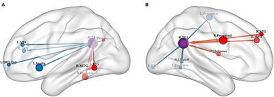 The Atypical Effective Connectivity of Right Temporoparietal Junction in Autism Spectrum Disorder: A Multi-Site Study